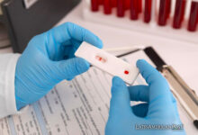 México Approves Home HIV Tests, Expanding Access and Early Treatment Opportunities