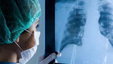 Latin American Pulmonary Hypertension Patients Defy Worldwide Expectations